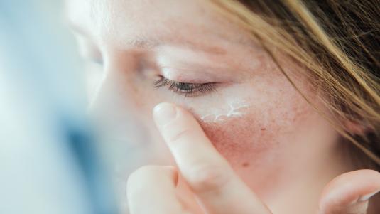 علاج احمرار وتصبغات الوجه بعد الحروق