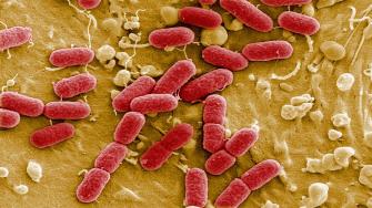 لم يتم عمل اختبار البكتيريا العقدية ب؟