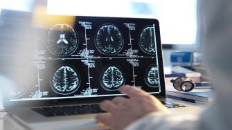 ما علاج أورام المخ؟