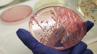 اختبار يكشف البكتيريا المقاومة للمضادات الحيوية في 30 دقيقة