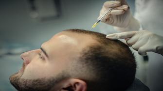 تساقط الشعر الوراثي.. وصفة علاجية