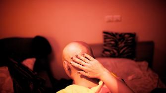 العلاج الكيميائي للسرطان وتساقط الشعر