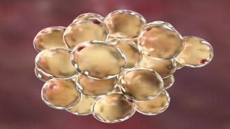 العلماء يحولون خلايا سرطان الثدي إلى خلايا دهنية 