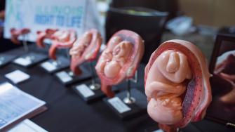 تطور الجنين في الثلث الثاني من الحمل