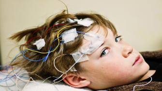 الديباكين وزيادة كهرباء الدماغ