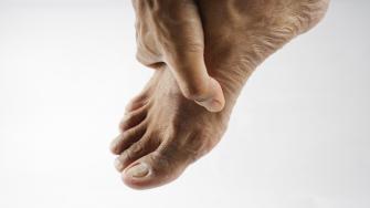 ألم واحمرار ظاهر القدم.. وصفة علاجية