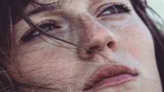 وصفة علاجية لاحمرار واسمرار الوجه بعد التقشير الكيميائي