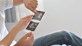 كيف اتأكد أني حامل بجنين متلازمة داون؟