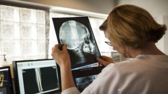ما دقة الأشعة السينية في إصابات الرأس؟