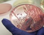 اختبار يكشف البكتيريا المقاومة للمضادات الحيوية في 30 دقيقة