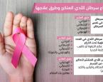 أنواع سرطان الثدي المتكرر وطرق علاجها