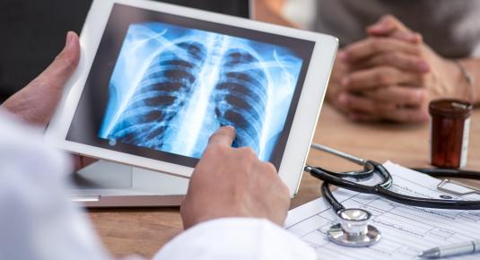 ما هو التهاب الرئة الإشعاعي وكيف يتم علاجه؟