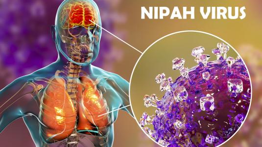 فيروس نيباه: الأعراض والأسباب والتشخيص والعلاج والوقاية