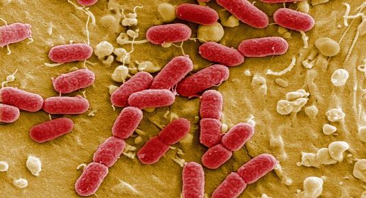 لم يتم عمل اختبار البكتيريا العقدية ب؟