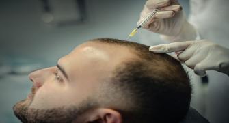 تساقط الشعر الوراثي.. وصفة علاجية