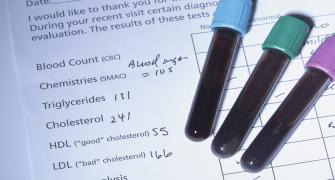 ارتفاع الكوليسترول رغم الحمية والأدوية