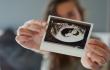 هل نتيجة سونار الحمل ثلاثي الأبعاد مضبوطة دائما؟